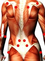 Triggerpunkte und Tenderpunkte sind die Ursache vieler Schmerzzustände Triggerpunkttherapie als Schmerzlinderung und Behandlung