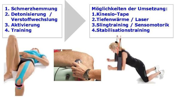 Umsetzung des Konzeptes durch Kinesiotape, Tiefenwärme, Slingtraining und Stabilisationstraining